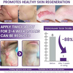 ReGenScar Stem Cell Repair Gel (Visible Scar Improvement in 7 Days)